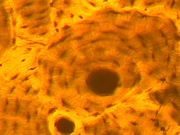 <p>Bone CT</p>