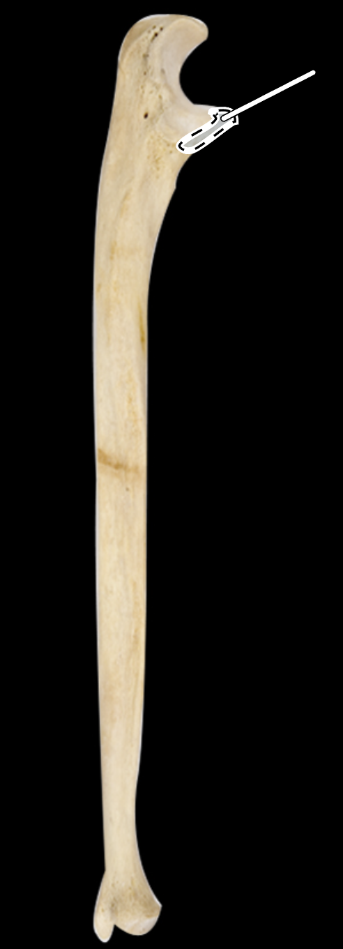 <p>Name the highlighted portion.</p><p>(Lateral view, right side).</p>