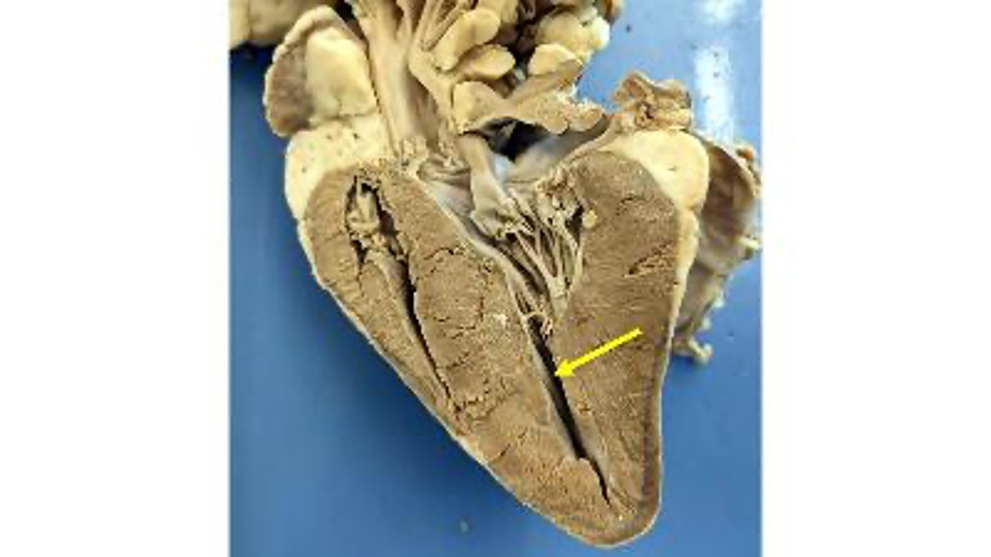 <p>Name the chamber</p>
