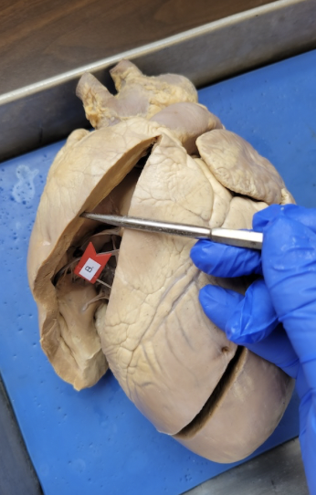 <p>right ventricle </p>