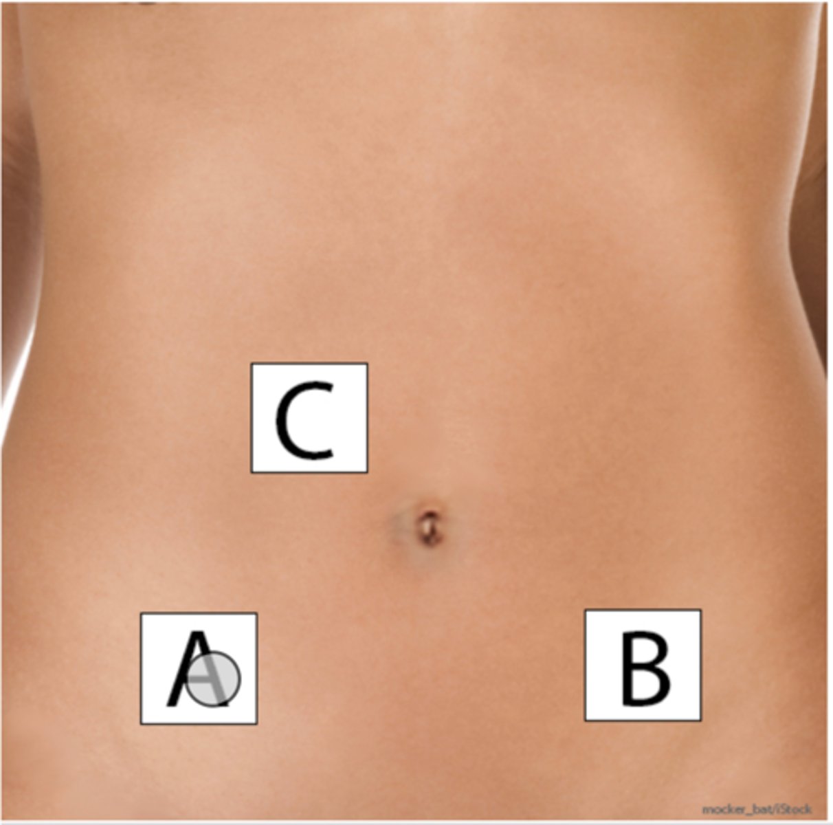 <p>A nurse in the emergency department is caring for an adolescent who has</p><p>severe abdominal pain due to appendicitis. Which of the following</p><p>locations should the nurse identify as mcburney's point?</p>