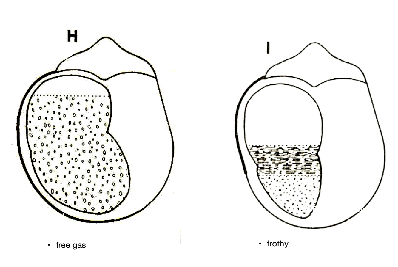 <ul><li><p>Production of stable, proteinaceous FOAM</p></li><li><p> Formed from leaf cytoplasmic 18-S soluble protein and saponins </p></li><li><p>FOAM traps normal amount of gases</p></li><li><p>CO2, methane</p></li><li><p>FOAM prevents the coalescence of small gas bubbles </p></li><li><p>Gas remains trapped in the rumen fluid</p></li></ul><p></p>