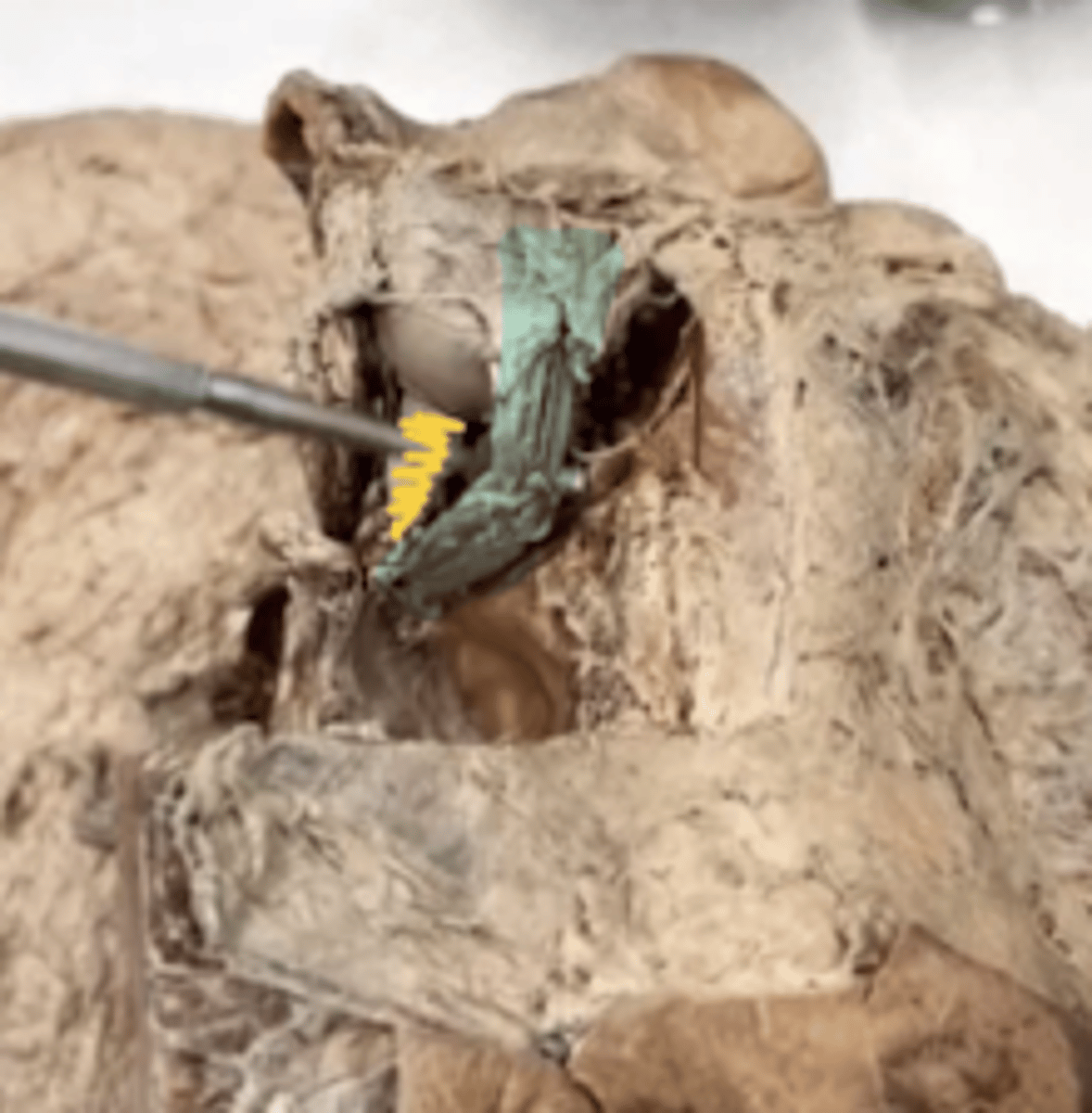 <p>Name the stucture. (yellow)</p>