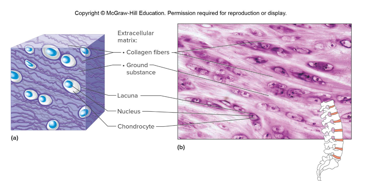 <p>Which cartilage is this </p>