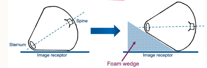 <ul><li><p><strong>avoid axial rotation of part of interest</strong></p></li><li><p>ensures accurate portrayal of part </p></li><li><p>makes positioning for limb views hard</p></li></ul><p>can use foam blocks for example. </p><p></p>