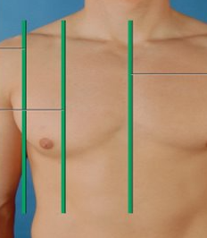 <p>runs down the front side of the body through the armpit&nbsp;</p>