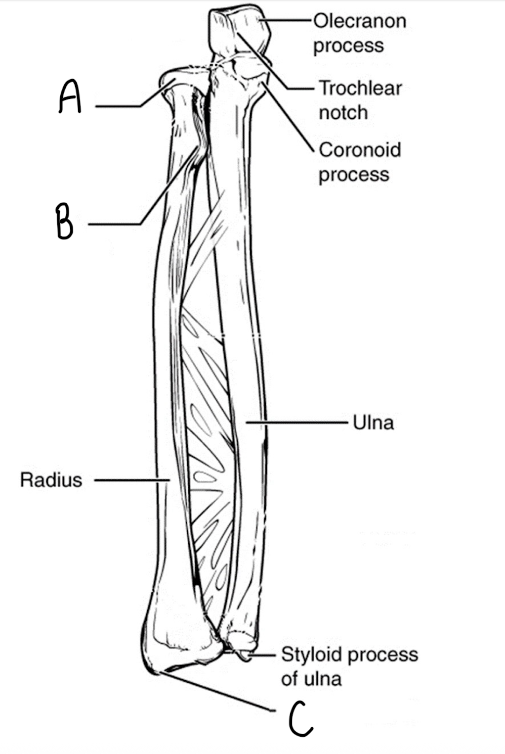 <p>Label the bone markings of the radius</p>