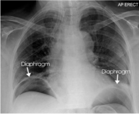 <p>What is this and what type of scan </p>