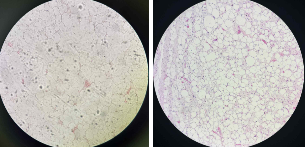<p>1. Specimen A and B?<br></p>
