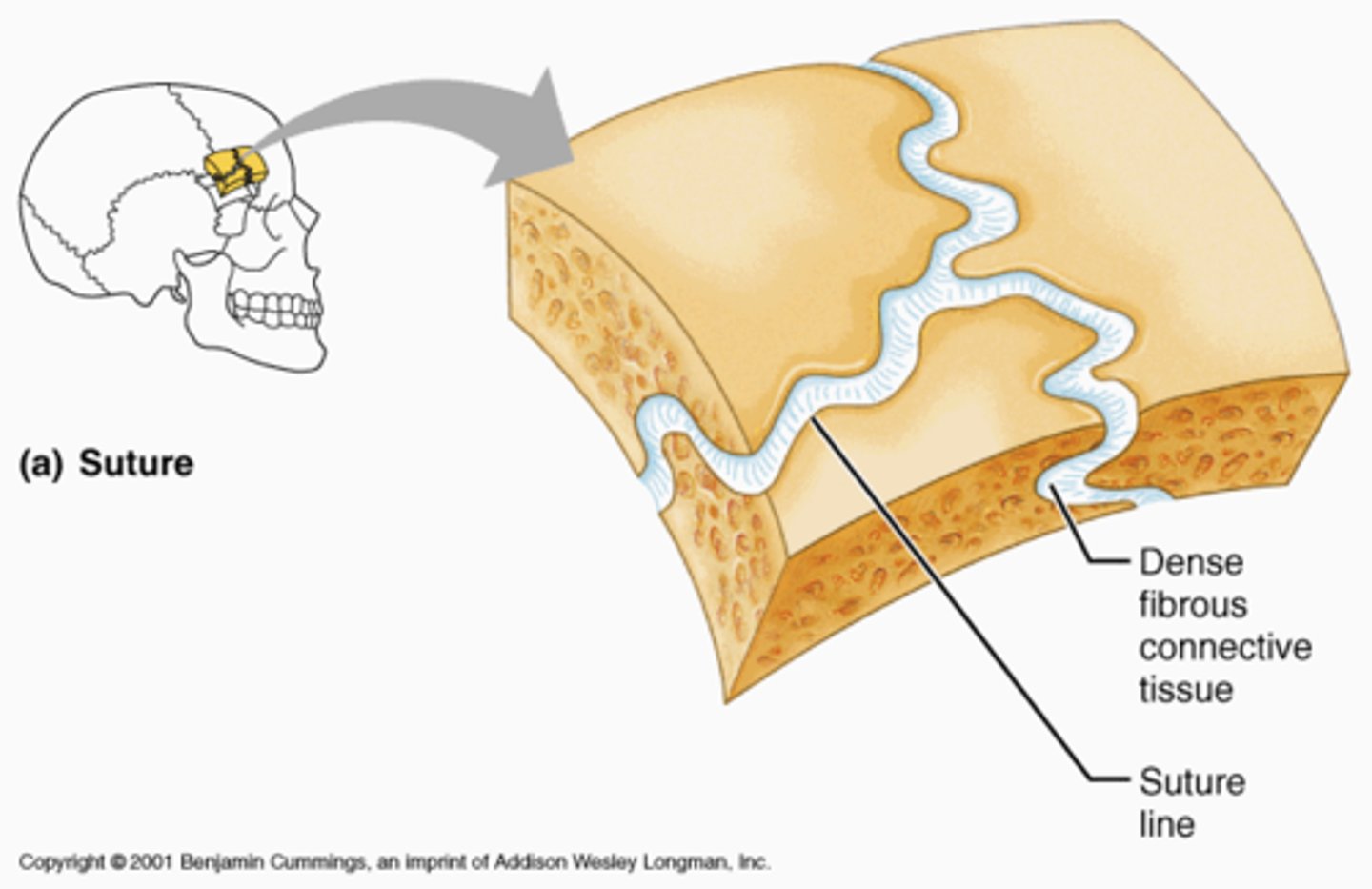 <p>joints which have no joint cavity (projections), but rather connect bones through connective tissue (cartilage). Often develop over time from childhood to adult.</p>