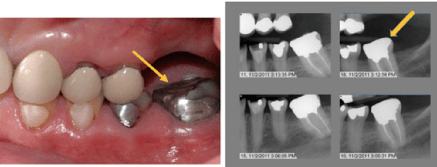 <p>What treatment do you suspect happened here?</p>