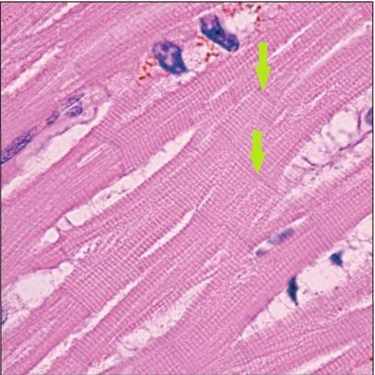 <p>Identify the lines.</p>