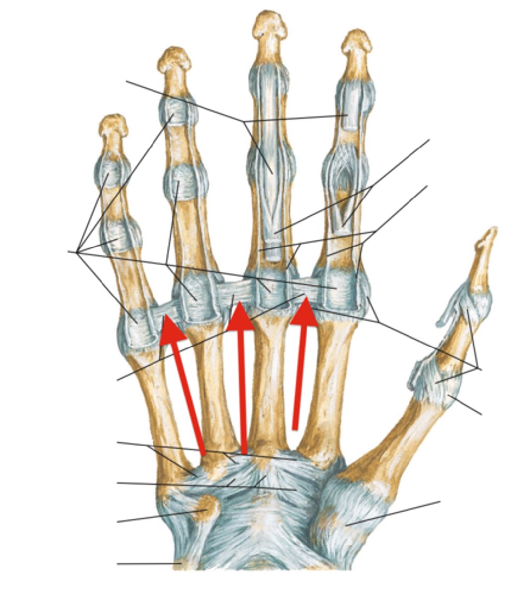 <p>Strong bands connecting volar plates of adjacent</p><p>finger MCP joints</p>
