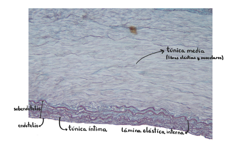 <p>Arteria coronaria (muscular)</p><p>Túnica media con fibras musculares lisas</p>