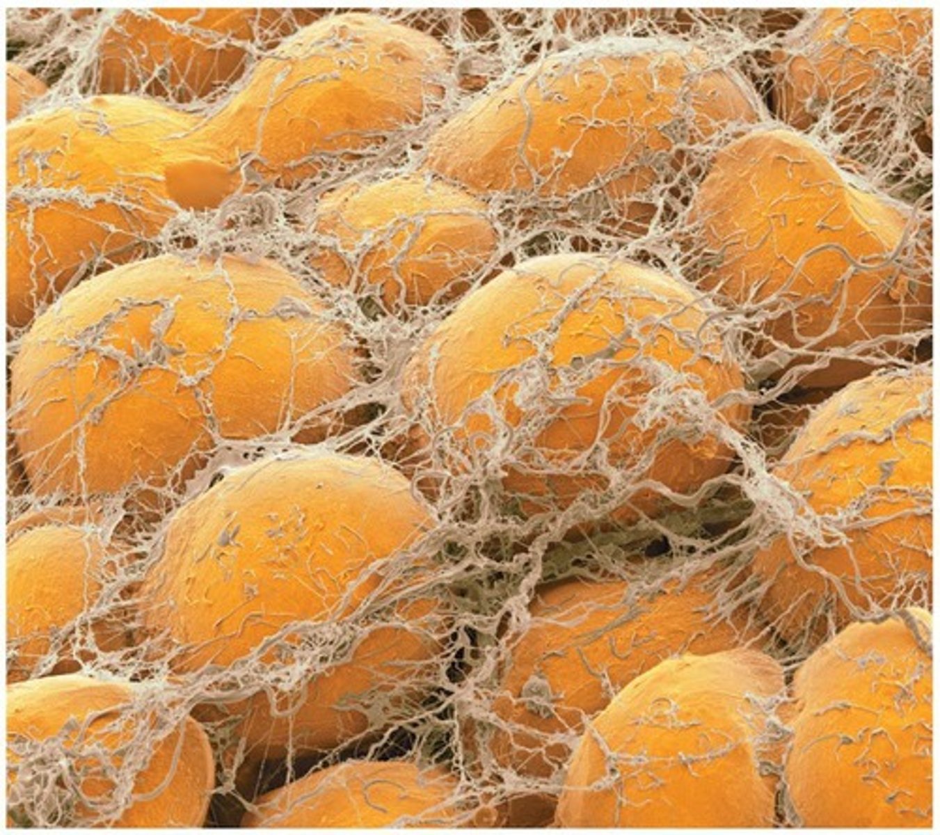 <p>A type of connective tissue that stores energy, insulates, and cushions organs.</p>
