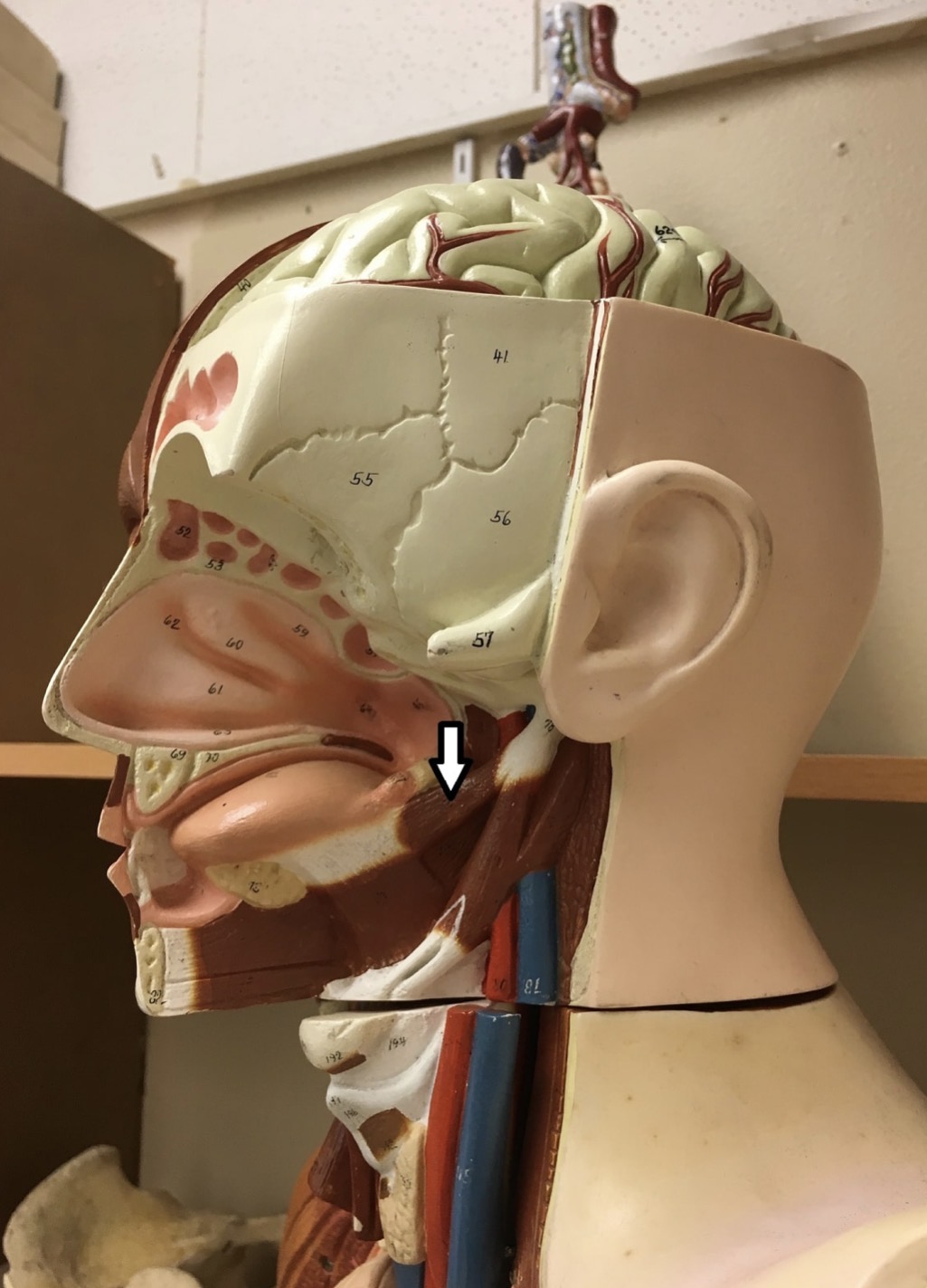 <p><span>Name the muscle labeled with the white arrow below:</span></p>