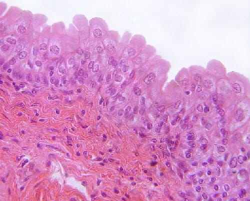 <p>Transitional Epithelium</p>