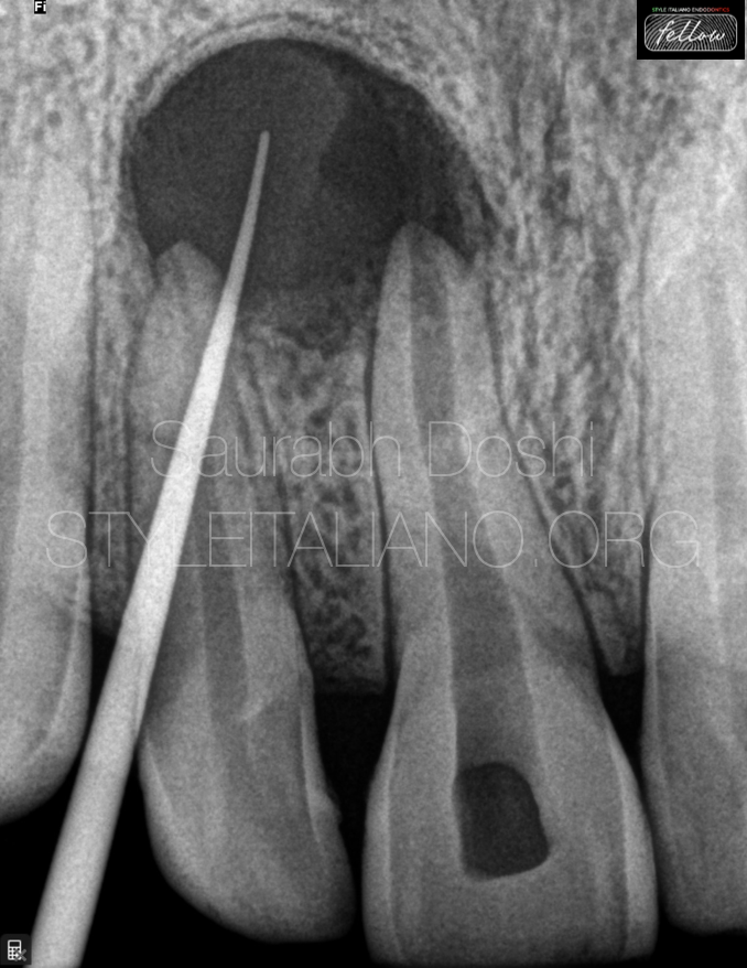 <p>what is a pano not used to evalulate </p>