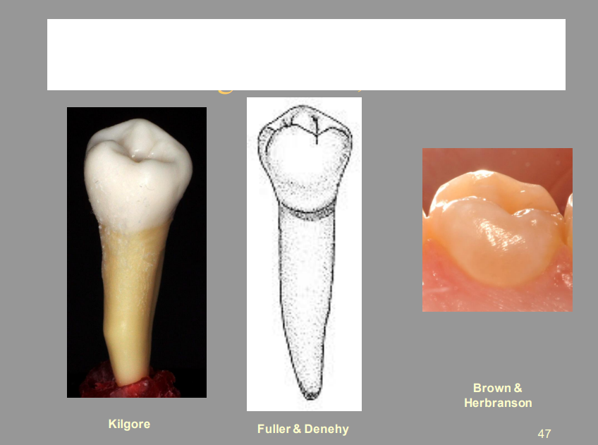 <p>From the Picture Shown, What Tooth Is This, And What View?</p>