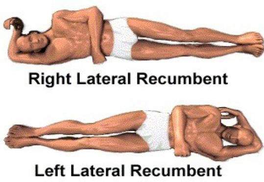<p>A position where the patient is lying on their right side getting a horizontal scan (bc right, ___ =side against imaging screen and not at an angle, ___ =lying down while getting a horizontal scan)</p>