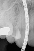 <p>What is the problem with this Wired Cable Issues X-ray?</p>