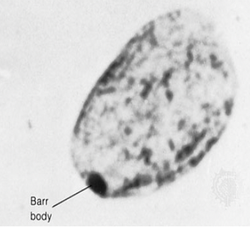 <p>Inactive X-chromosome in females </p>
