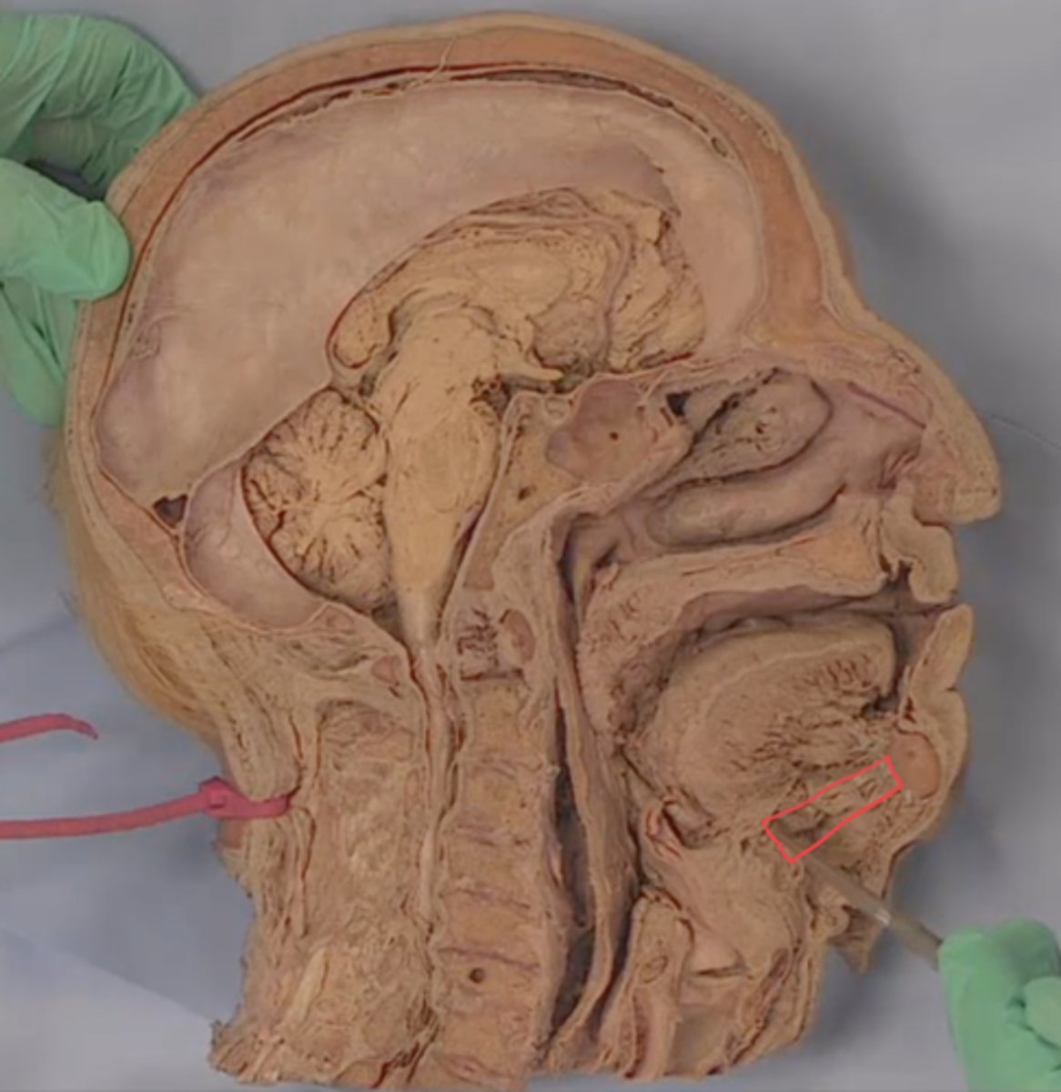 <p>identify this structure</p>