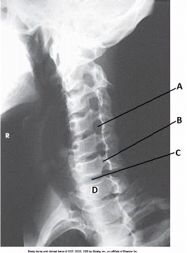 <p><span>What anatomy is labeled with the letter&nbsp;</span><em>A</em><span>&nbsp;in the image below?</span></p>