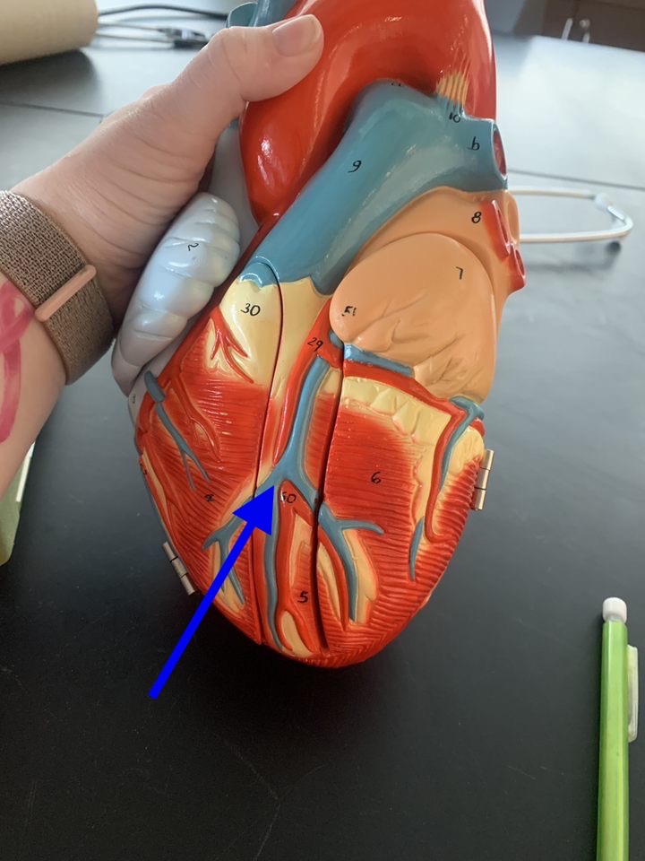 Name the heart structure.