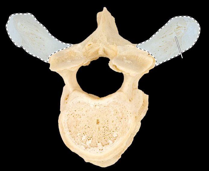 <p>What part of the vertebra is highlighted?</p><p>What type of vertebra is this (which region is this vertebra from)?</p><p>(Superior view).</p>