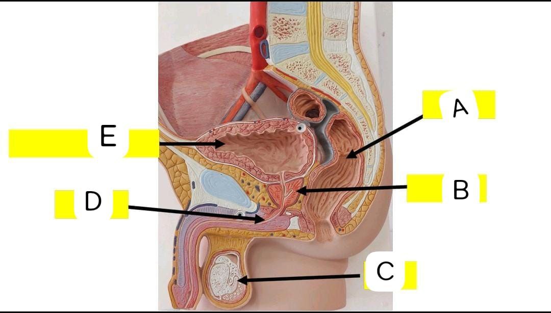 <p>Identify the following</p>