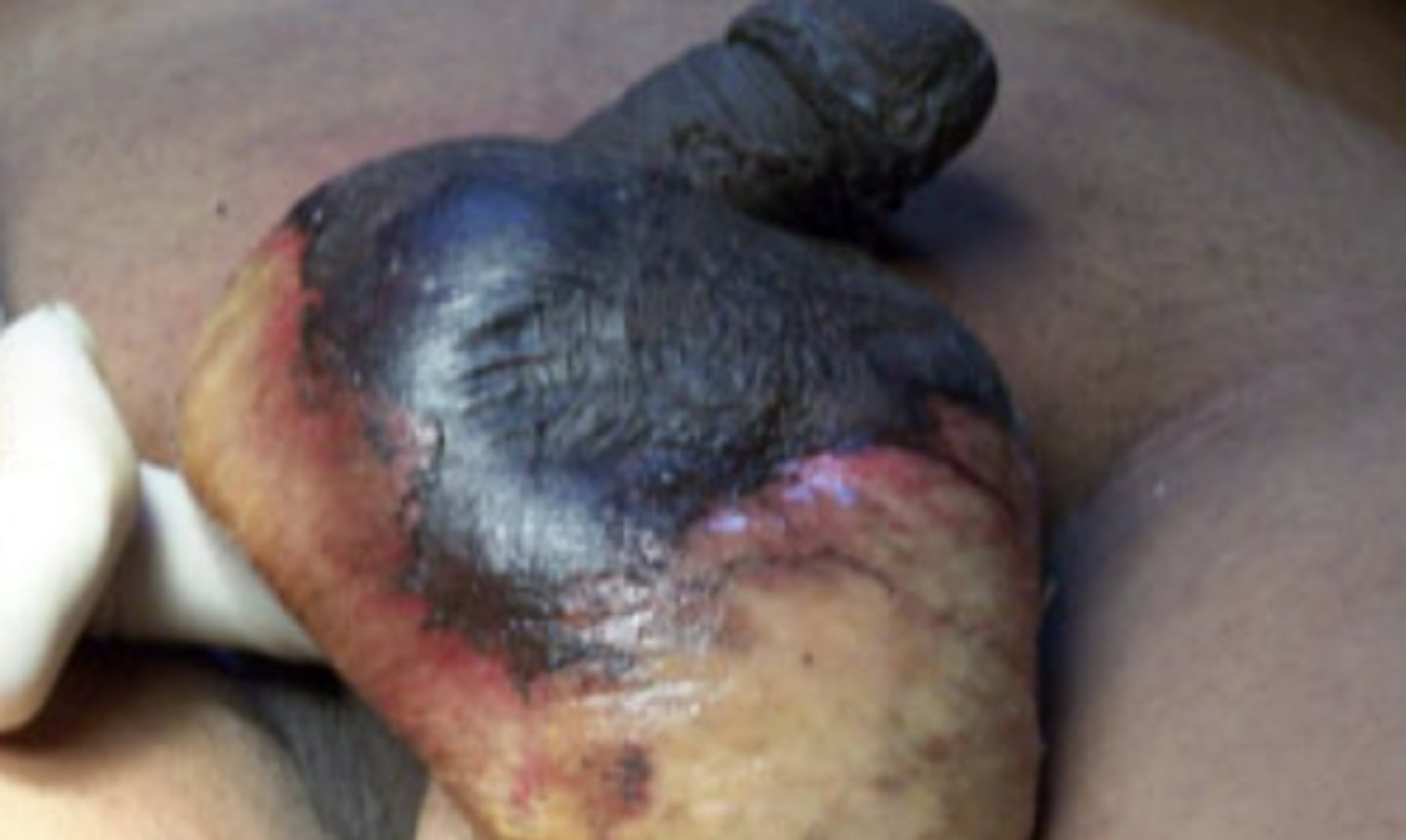 <p>What is the diagnosis?</p>