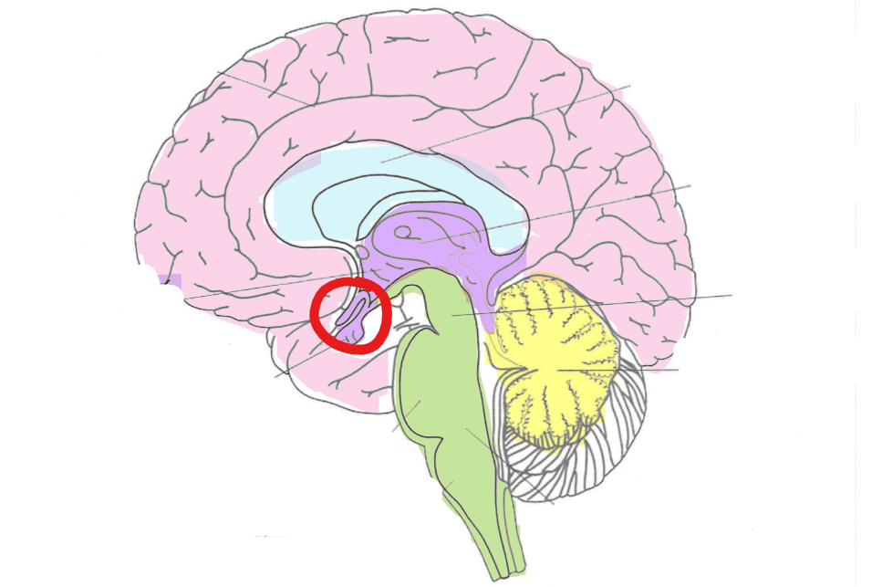 term image