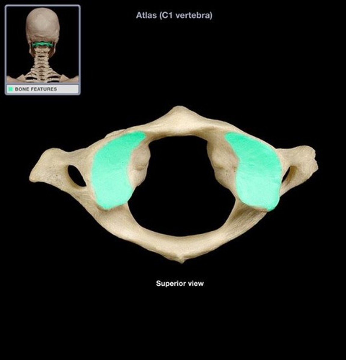 <p>articulates with occipital condyles of the occipital bone and forms the atlanto-occipital joint</p>