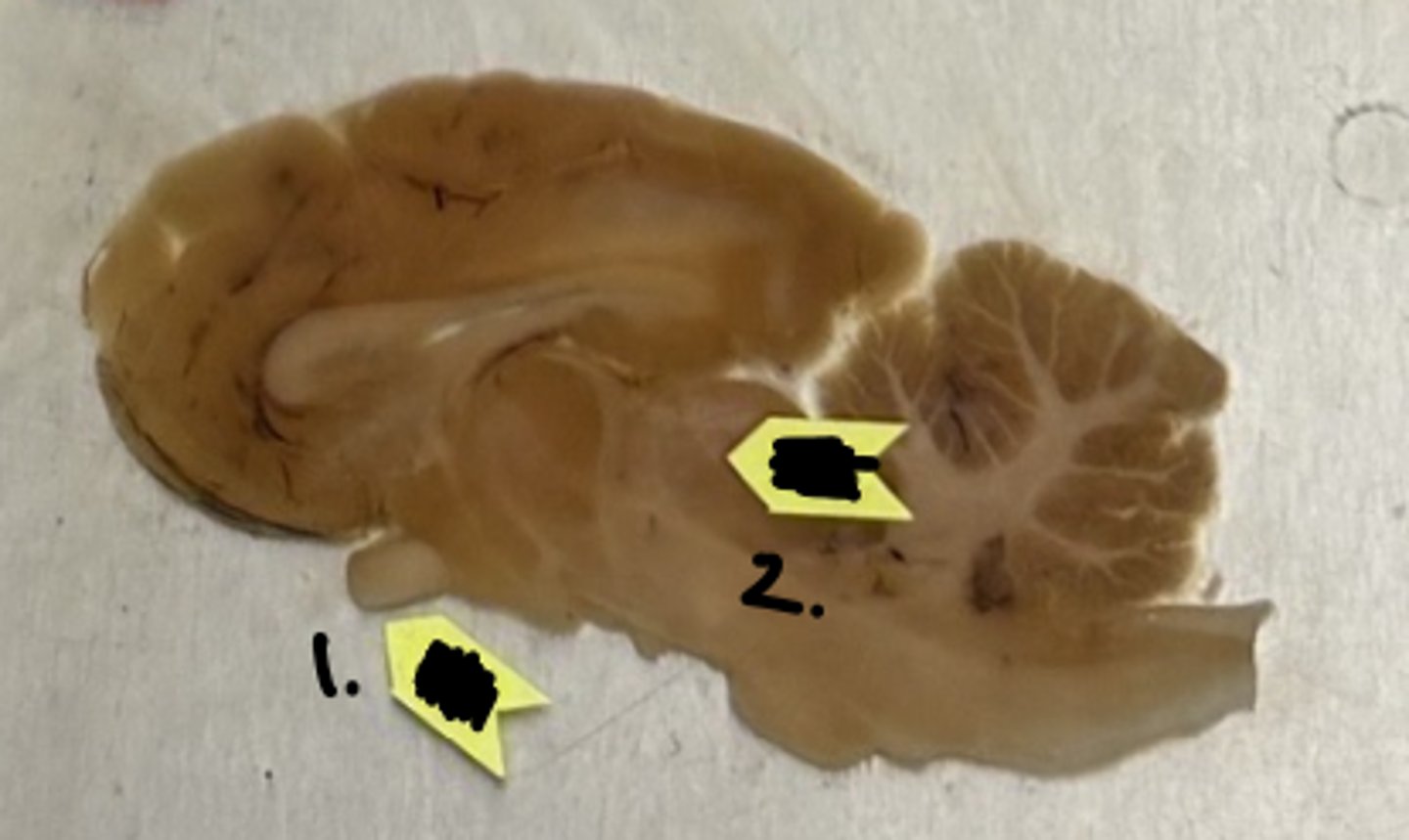 <p>what structure is labeled as #1 ?</p>