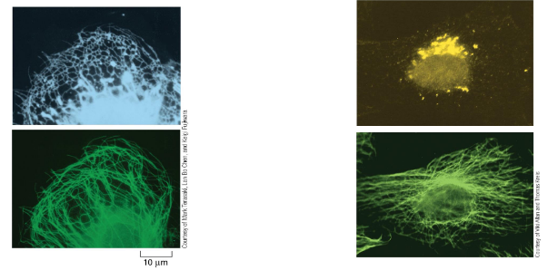 <p>ER attaches to microtubules — tubes extend to periphery</p><ul><li><p>kinesin is the motor protein (remember — moves out to periphery)</p></li></ul><p>golgi attaches to microtubules — keeps it “collapsed”/pulled in so it remains near nucleus</p><ul><li><p>dynein is the motor protein (remember — pulls inward)</p></li></ul><p></p>