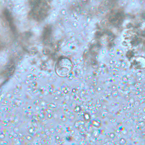 <p>large glycogen vacuole</p>