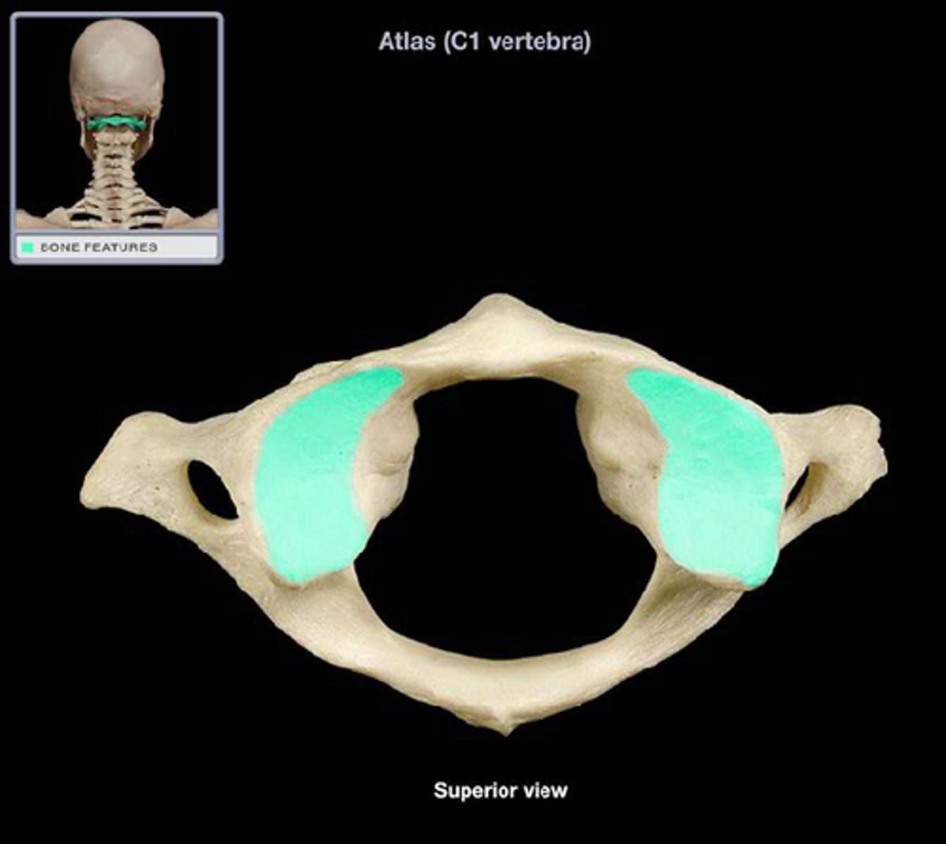 <p>articulates with occipital condyle</p>
