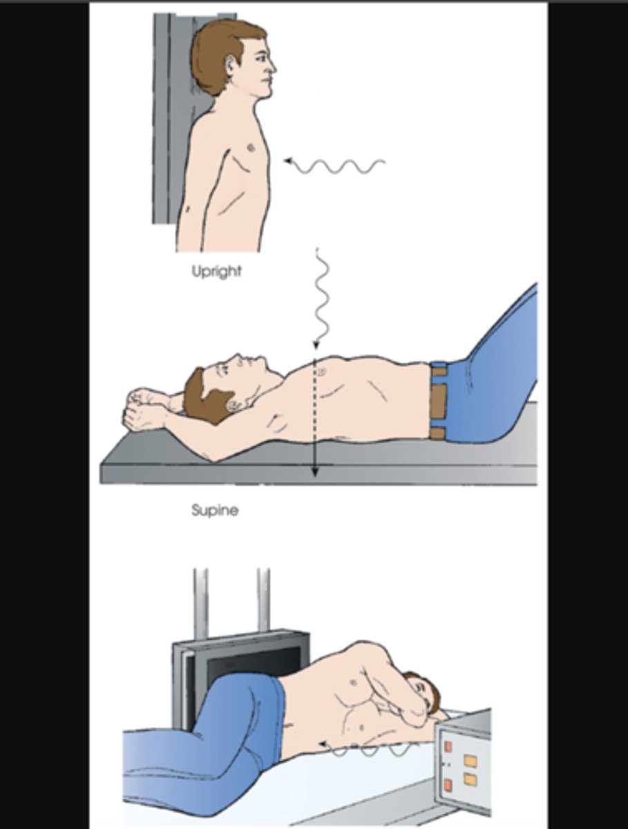 <p>central ray passes perpendicular to the coronal plane, from anterior to posterior</p><p>FRONT TO BACK</p>