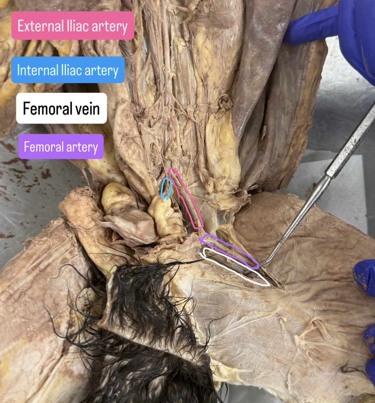 <p>External iliac artery, internal Iliac artery, femoral vein, femoral artery</p>