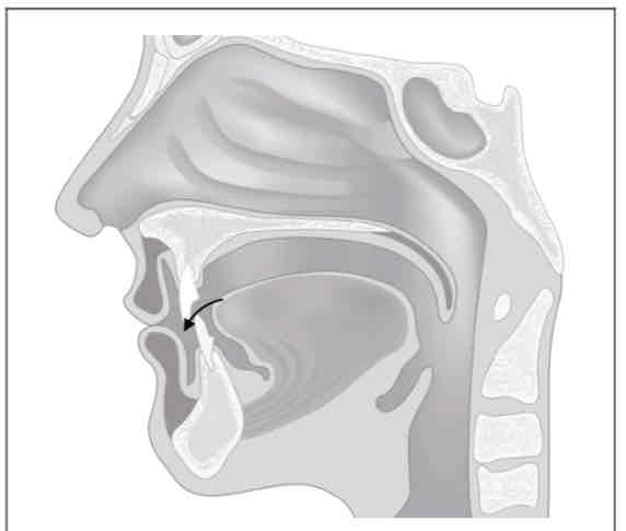 <p>What is this place of articulation? (Tongue tip near/between teeth)</p>