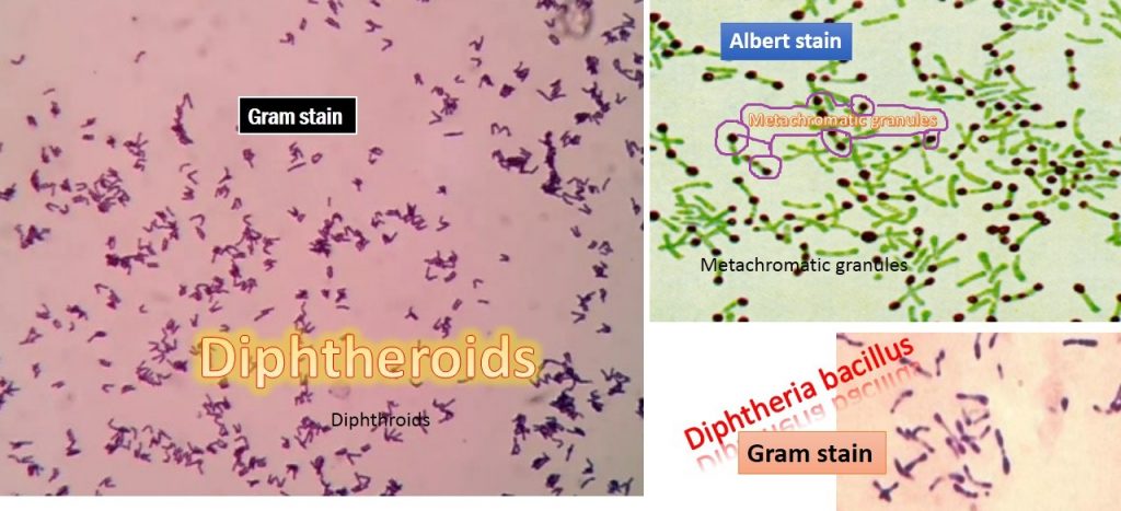 <p>c) Club-shaped Gram-positive rods with<span style="color: red"><strong> red </strong></span>metachromatic granules</p><div data-type="horizontalRule"><hr></div><p>Looks like chinese characters in Hx</p>