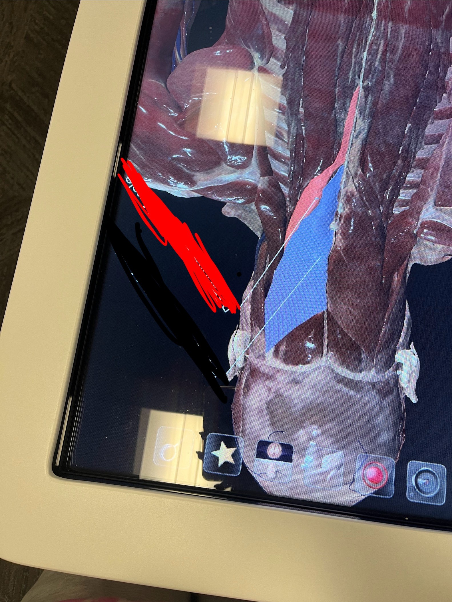 <p>What spinal muscle is highlighted in blue</p>