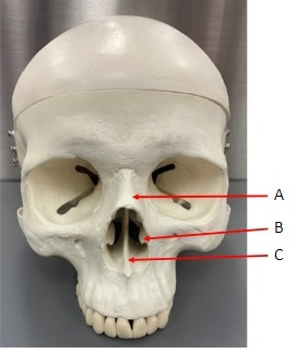<p>Identify</p>