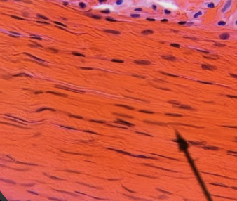 <p>what kind of tissue is this </p>