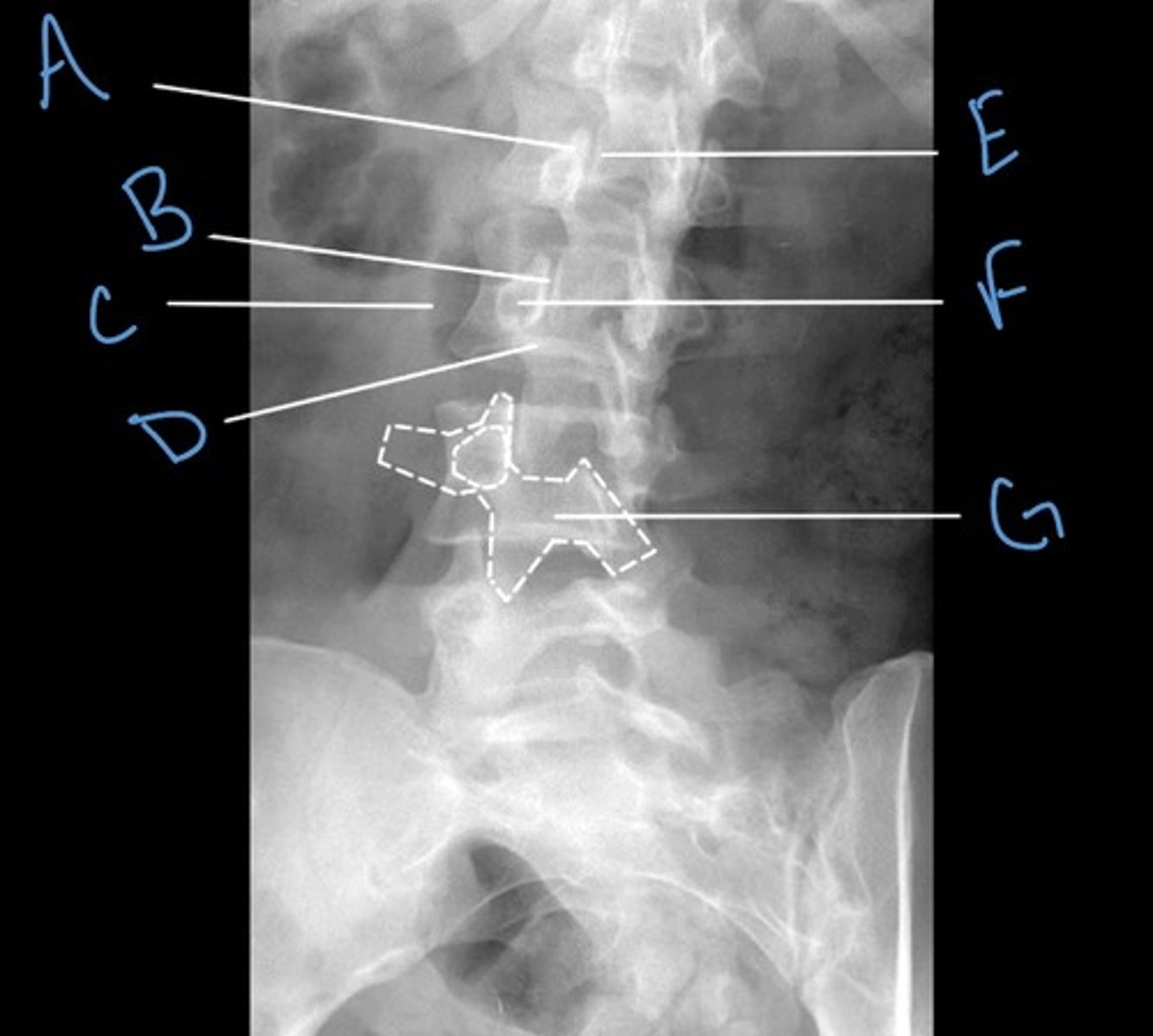 <p>Label the anatomy indicated by letter C:</p>