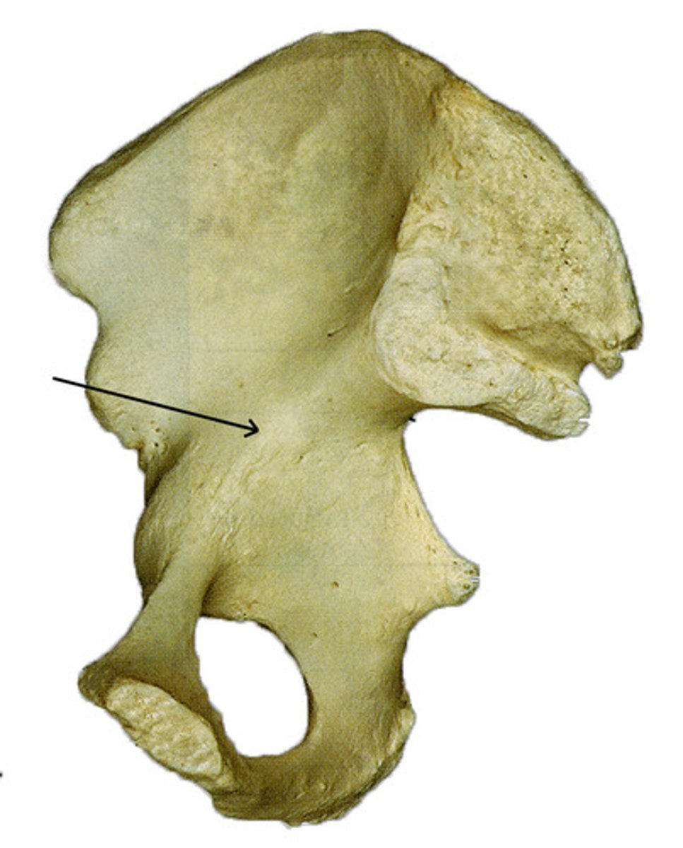 <p>a ridge of bone that runs inferiorly and anteriorly from the auricular surface</p>
