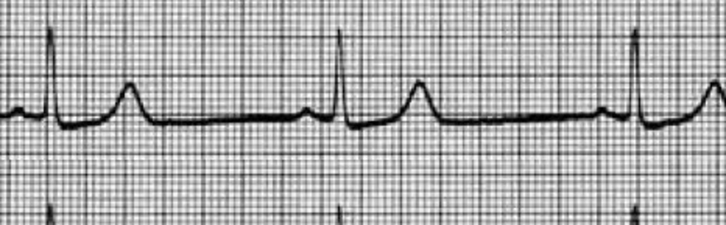 <p>What does this image represent</p>