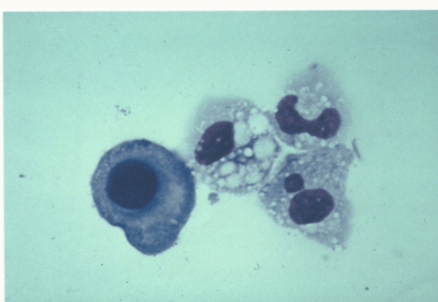 <p>Identify the cells in this body fluid</p>