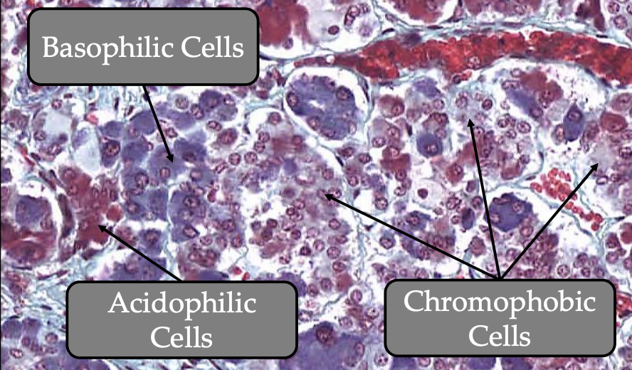 <p><strong><u>What:</u> <mark data-color="red" style="background-color: red; color: inherit;">Undifferentiated, non secretory stem cells</mark></strong></p><p><strong><u>Cytoplasm:</u></strong><span style="color: rgb(201, 24, 74);"><strong> </strong></span><strong><mark data-color="red" style="background-color: red; color: inherit;">Light colored homogenous </mark></strong></p><p><strong><u>Nucleus:</u> <mark data-color="red" style="background-color: red; color: inherit;">Large</mark> </strong></p><p></p>